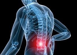 腰背痛成因物理治療