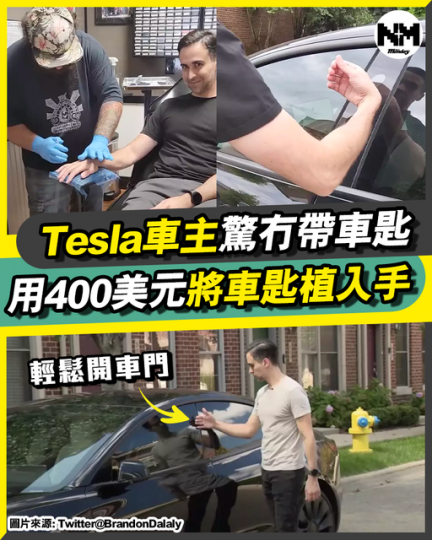 Tesla車主驚冇帶車匙 用400美元將車匙植入手...