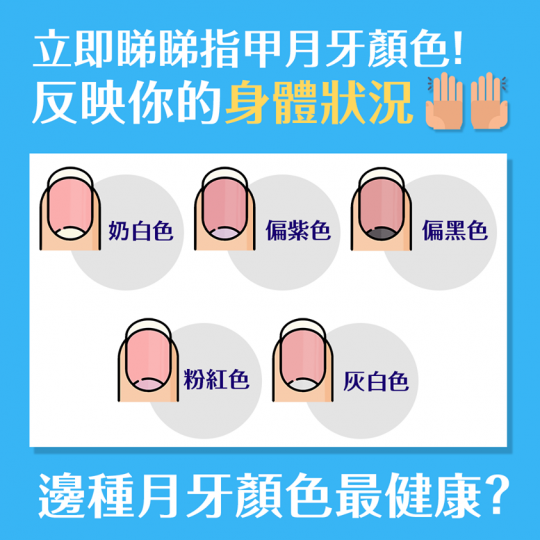 大家平日剪指甲的時候,會不會留意自己指甲根部有沒有彎月形狀的月牙呢?
中醫認為月牙能夠反映一些健康,例如氣血充足,指甲就會堅韌,有光澤。而指甲的拇指、食指、中指應該都要有月牙作為基本,顏色為奶白色,若... 大家平日剪指甲的時候,會不會留意自己指甲根部有沒有彎月形狀的月牙呢?
中醫認為月牙能夠反映一些健康,例如氣血充足,指甲就會堅韌,有光澤。而指甲的拇指、食指、中指應該都要有月牙作為基本,顏色為奶白色,若...