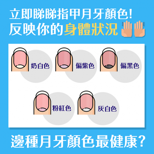 大家平日剪指甲的時候，會不會留意自己指甲根部有沒有彎月形狀的月牙呢？
中醫認為月牙能夠反映一些健康，例如氣血充足，指甲就會堅韌，有光澤。而指甲的拇指、食指、中指應該都要有月牙作為基本，顏色為奶白色，若...