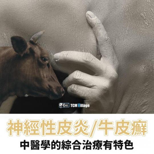 這個皮膚病實在太古怪,白天多數沒事,但當接近黃昏五六點左右就開始發作,一直瘙癢難耐,直到半夜,沒法入睡…
神經性皮炎/牛皮癬的中醫特色治療 (了解更多)
https://www.tcmvclinic.... 這個皮膚病實在太古怪,白天多數沒事,但當接近黃昏五六點左右就開始發作,一直瘙癢難耐,直到半夜,沒法入睡…
神經性皮炎/牛皮癬的中醫特色治療 (了解更多)
https://www.tcmvclinic....