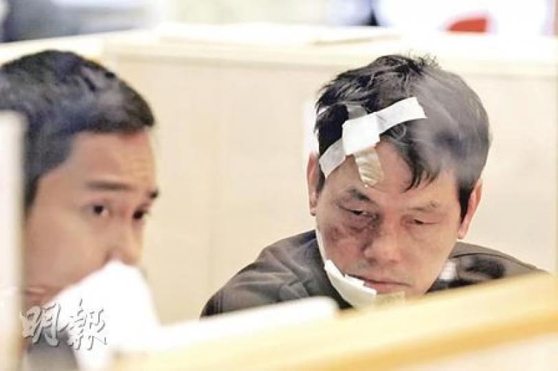 姓翟的士司機無辜被醉酒乘客襲擊，額頭和口角受傷，眼眶瘀黑，更損失大半晚收入，送院接受治療時一臉無奈。（蔡方山攝）醉酒男子乘的士期間失常，多次箍司機頸，又咬傷司機嘴，導致的士在九龍城失事撞欄，幸未有鬧出人命。（蔡方山攝）
