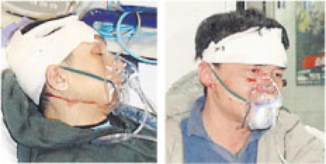 兩名男子在西環食肆對鄰桌女子評頭品足,離開時遭人毆至頭破血流,救護員接報到場為二人處理傷勢。(衛永康攝) 兩名男子在西環食肆對鄰桌女子評頭品足,離開時遭人毆至頭破血流,救護員接報到場為二人處理傷勢。(衛永康攝)