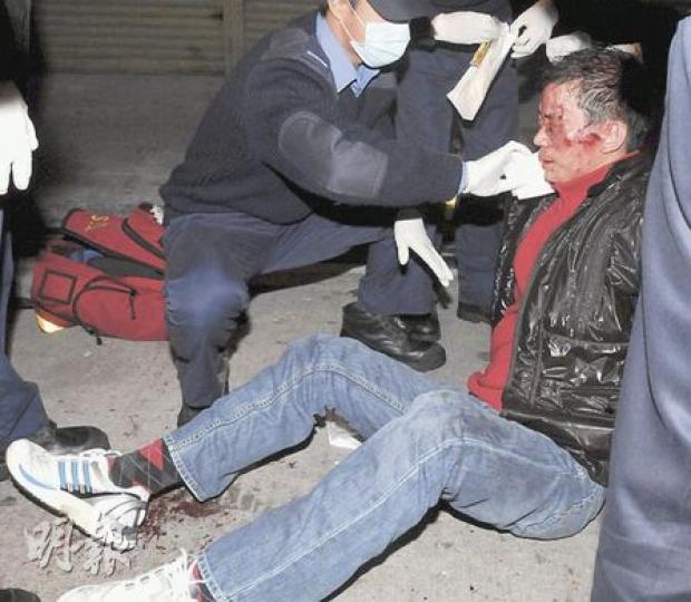 酒吧東主在消夜後遭人伏擊,被人用水喉鐵通扑傷頭部。(蔡方山攝)酒吧東主遇襲後,其妻驚魂未定。(蔡方山攝) 酒吧東主在消夜後遭人伏擊,被人用水喉鐵通扑傷頭部。(蔡方山攝)酒吧東主遇襲後,其妻驚魂未定。(蔡方山攝)