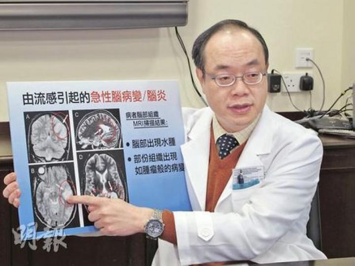 香港中文大學腦神經科主任黃家星說,流感併發急性腦炎病情可於兩天內迅速惡化,死亡率高達四成。(余卓善攝) 香港中文大學腦神經科主任黃家星說,流感併發急性腦炎病情可於兩天內迅速惡化,死亡率高達四成。(余卓善攝)