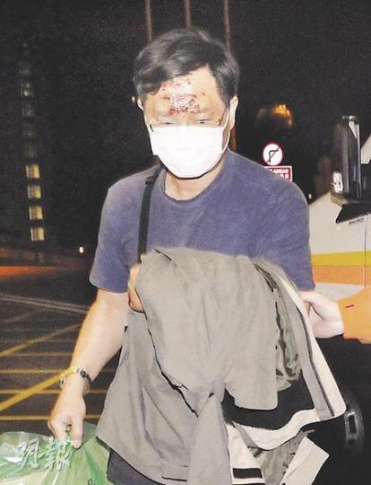 一名在山東遇上車禍的港人,昨凌晨返港後被送往瑪嘉烈醫院治理,額頭遺下大幅傷痕。(蔡方山攝) 一名在山東遇上車禍的港人,昨凌晨返港後被送往瑪嘉烈醫院治理,額頭遺下大幅傷痕。(蔡方山攝)