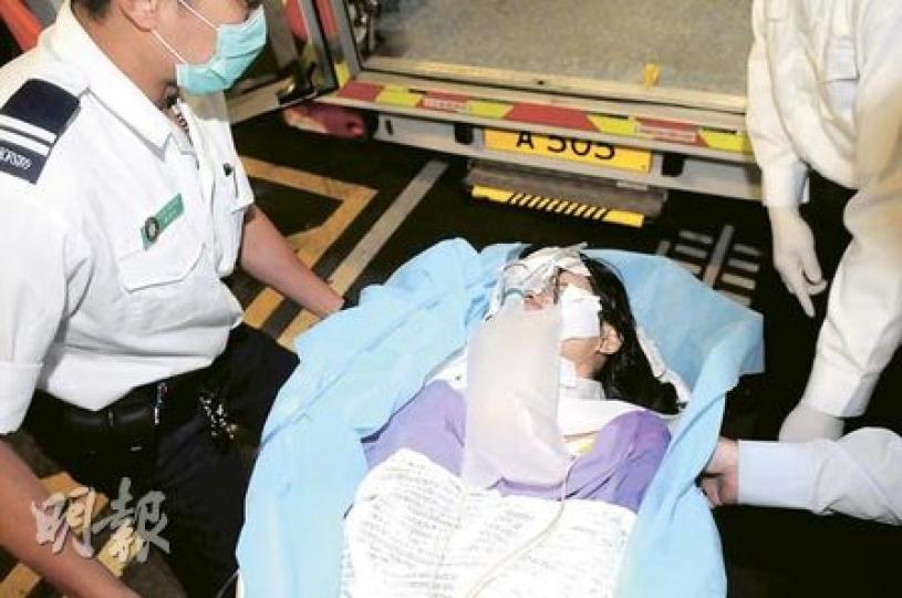 16歲少女兩成皮膚灼傷,包括臉及胸口,恐有毁容之虞。(衛永康攝) 16歲少女兩成皮膚灼傷,包括臉及胸口,恐有毁容之虞。(衛永康攝)