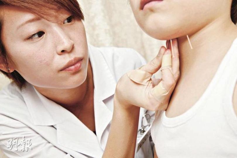 港大中醫藥臨牀教研中心鄭曉婷醫師(左),為麥太太的6歲兒子在下巴的上廉泉及夾上廉泉等穴位施針。她指該穴位可刺激小朋友說話,改善溝通能力。(張智良攝) 港大中醫藥臨牀教研中心鄭曉婷醫師(左),為麥太太的6歲兒子在下巴的上廉泉及夾上廉泉等穴位施針。她指該穴位可刺激小朋友說話,改善溝通能力。(張智良攝)
