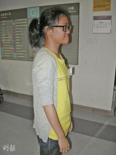 曾因不注意飲食致小五體重已達60公斤的Emily,中學時一次病發令她改變壞習慣,嚴厲戒口,現時體重49公斤。(曾映妹攝) 曾因不注意飲食致小五體重已達60公斤的Emily,中學時一次病發令她改變壞習慣,嚴厲戒口,現時體重49公斤。(曾映妹攝)