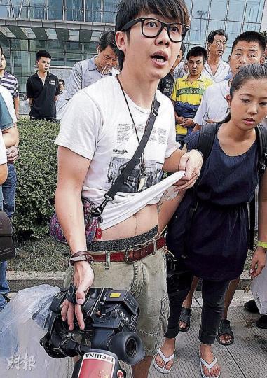 遇襲的本港電視台攝影師雷釗河(上圖)展示腹部抓痕。下圖見其右手拇指被人抓破流血。(明報記者攝) 遇襲的本港電視台攝影師雷釗河(上圖)展示腹部抓痕。下圖見其右手拇指被人抓破流血。(明報記者攝)