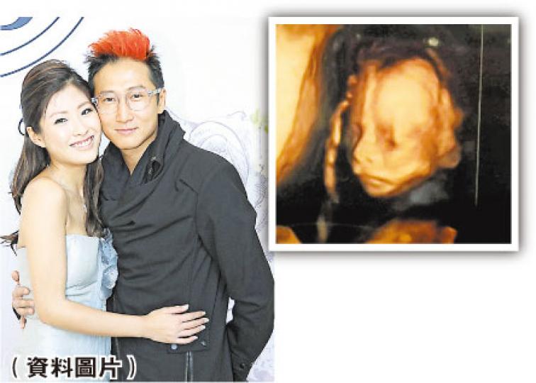 BB鼻樑高高，大家覺得似爸爸洪天明？還是媽咪周家蔚呢？（微博圖片）