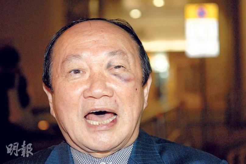 詹培忠昨午被兩名神秘男子襲擊,左眼有明顯瘀傷,臉頰及嘴唇均有擦損,詹培忠表示不認識施襲者,亦不知因何事得罪人。(伍浦鋒攝) 詹培忠昨午被兩名神秘男子襲擊,左眼有明顯瘀傷,臉頰及嘴唇均有擦損,詹培忠表示不認識施襲者,亦不知因何事得罪人。(伍浦鋒攝)