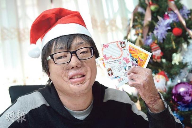 曾經歷無情山火令身體重創的張潤衡,現時積極以自身經歷向社會發放正能量,自言是「小薯仔」的衡仔組織義工及學生,今日在街頭「快閃」派心意卡及暖包,希望社會增添微笑。(盧翊銘攝) 曾經歷無情山火令身體重創的張潤衡,現時積極以自身經歷向社會發放正能量,自言是「小薯仔」的衡仔組織義工及學生,今日在街頭「快閃」派心意卡及暖包,希望社會增添微笑。(盧翊銘攝)
