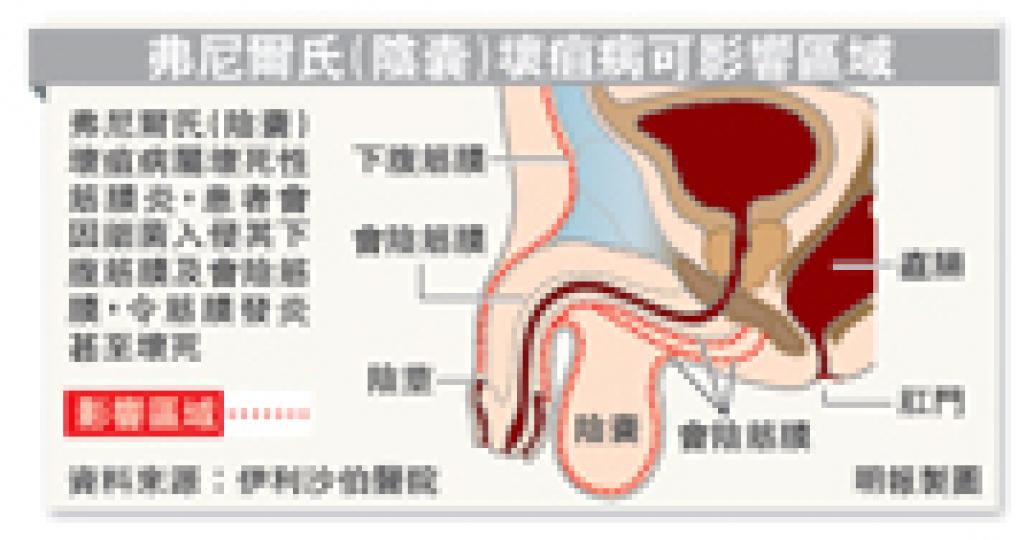 (明報製圖) (明報製圖)