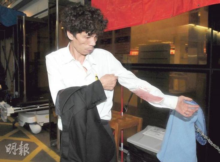 失業漢賭輸錢復遭露宿者用木棍毆傷,事後展示傷勢。(蔡方山攝)油麻地佐治五世公園傷人案現場,仍有大量露宿者雜物,而引起今次風波的牀褥仍放在一旁。(蔡方山攝) 失業漢賭輸錢復遭露宿者用木棍毆傷,事後展示傷勢。(蔡方山攝)油麻地佐治五世公園傷人案現場,仍有大量露宿者雜物,而引起今次風波的牀褥仍放在一旁。(蔡方山攝)