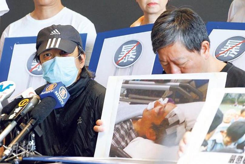 上周在旺角出席支聯會悼念內地民運人士李旺陽逝世一周年的陳先生(左),昨日出席泛民記者會促警緝兇,可見其眼部傷勢未癒。圖右為支聯會主席李卓人。(李紹昌攝) 上周在旺角出席支聯會悼念內地民運人士李旺陽逝世一周年的陳先生(左),昨日出席泛民記者會促警緝兇,可見其眼部傷勢未癒。圖右為支聯會主席李卓人。(李紹昌攝)