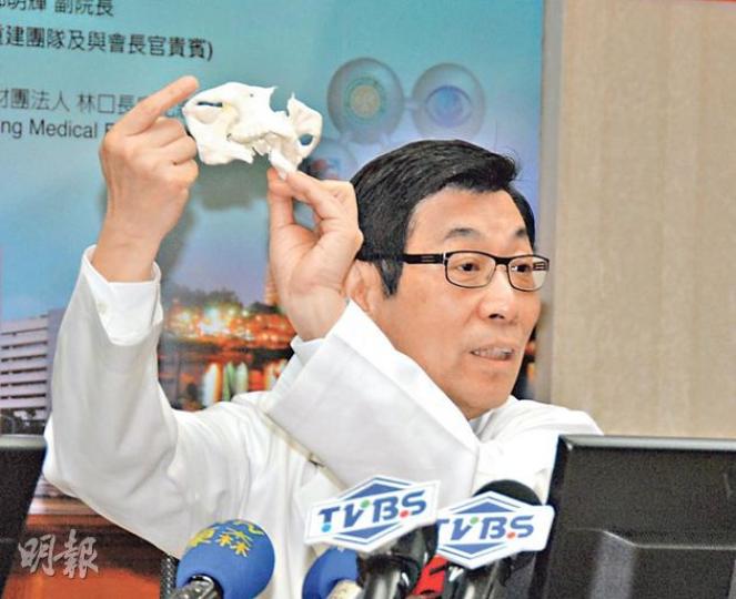 主診醫生魏福全舉起易小玲口腔的3D模型講解手術詳情,他指手術成功,若康復進度理想,4至6個月後便可以為易小玲植牙。(曾映妹攝) 主診醫生魏福全舉起易小玲口腔的3D模型講解手術詳情,他指手術成功,若康復進度理想,4至6個月後便可以為易小玲植牙。(曾映妹攝)