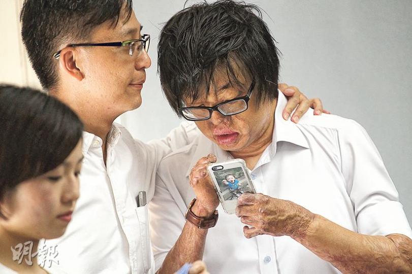 灼傷互助會副主席張潤衡(右)昨召開記者會,表示3個月內完成交接後辭去副主席及執委職務。近日飽受困擾的他,獲會內同伴安慰,表達支持。(李紹昌攝) 灼傷互助會副主席張潤衡(右)昨召開記者會,表示3個月內完成交接後辭去副主席及執委職務。近日飽受困擾的他,獲會內同伴安慰,表達支持。(李紹昌攝)