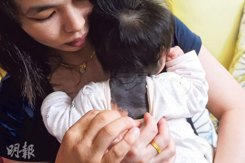 陳太一家遷進葵聯邨後懷上幼女,惟幼女一出生便長滿黑痣,右背、胸口及整隻右手被黑痣覆蓋,被觸摸會疼痛大哭。於傳媒曝光後陳氏夫婦被人指指點點,甚至有人懷疑他們照顧不周令女兒出現黑痣,陳太大感無奈。(鄧宗弘攝) 陳太一家遷進葵聯邨後懷上幼女,惟幼女一出生便長滿黑痣,右背、胸口及整隻右手被黑痣覆蓋,被觸摸會疼痛大哭。於傳媒曝光後陳氏夫婦被人指指點點,甚至有人懷疑他們照顧不周令女兒出現黑痣,陳太大感無奈。(鄧宗弘攝)