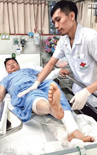 62歲港人朱日安雙腳嚴重受傷,至今未能落地的他表示爆炸當日「只知要拖住太太快點走」,而不知道自己受傷。(曾映妹攝) 62歲港人朱日安雙腳嚴重受傷,至今未能落地的他表示爆炸當日「只知要拖住太太快點走」,而不知道自己受傷。(曾映妹攝)
