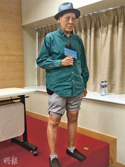 65歲的黃伯（圖）因關節退化令雙膝變形疼痛，手術前拄拐杖走路不能多於5分鐘，去年11月置換左膝關節後，即日已下牀走路，左膝不再痛，現時其右膝仍有變形，計劃今年10月再做手術。（梁杏怡攝）