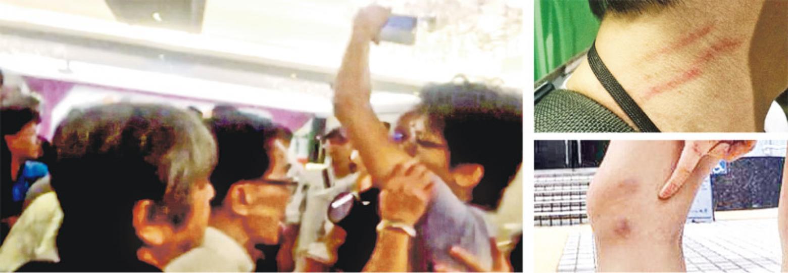 本報記者前晚在宴會現場舉起手機拍攝，被多名賓客包圍和推撞（左圖），手機更被奪去，至今仍未尋回。該名記者頸和手部受傷（右上圖），另一名在場的記者亦有多處瘀傷（右下圖）。（明報記者攝）重案組警員昨到尖沙嘴德興火鍋酒家，就前晚記者被包圍推撞和受傷展開調查。（郭慶輝攝）