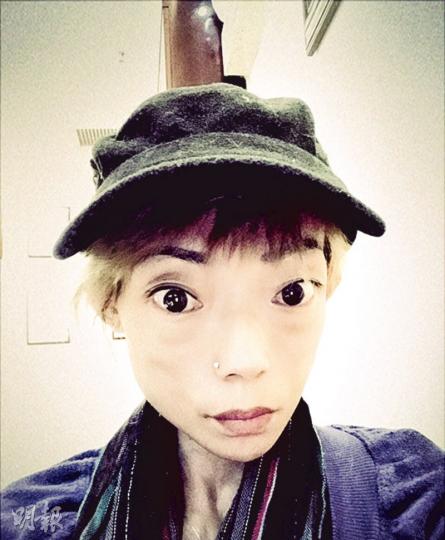 郭永淳前妻伍智恒上載照片指自己目前只有50多磅。(微博圖片) 郭永淳前妻伍智恒上載照片指自己目前只有50多磅。(微博圖片)
