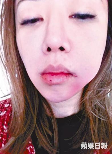 ■姜紫藍話大前晚俾男友毆打,要報警同入院驗傷。■去年姜紫藍因男友破產取消峇里婚禮。 ■姜紫藍話大前晚俾男友毆打,要報警同入院驗傷。■去年姜紫藍因男友破產取消峇里婚禮。