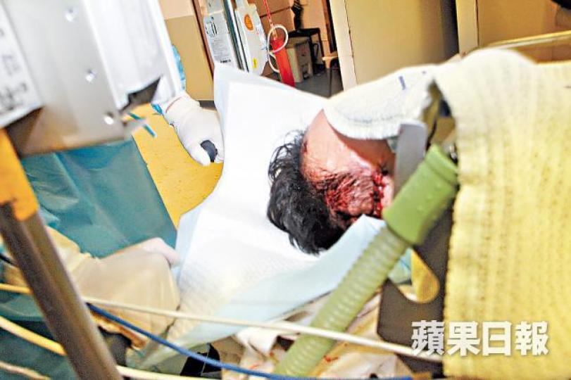 ■中年男遭妻子斬傷頭部昏迷送院。司徒韋桐攝