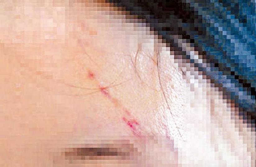 ■C女額頭被打傷後留下的疤痕。台灣《蘋果日報》■C女遭人擄到圖中的汽車旅館性侵。台灣《蘋果日報》 ■C女額頭被打傷後留下的疤痕。台灣《蘋果日報》■C女遭人擄到圖中的汽車旅館性侵。台灣《蘋果日報》