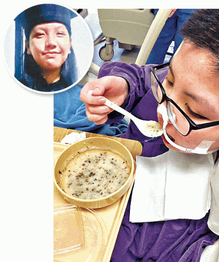 ■中風姓陳少女(圓圖)現已可進食粥及碎菜。家屬提供圖片■少女胞兄質疑聯院報告無誠意,將發信予醫管局提出質疑。 ■中風姓陳少女(圓圖)現已可進食粥及碎菜。家屬提供圖片■少女胞兄質疑聯院報告無誠意,將發信予醫管局提出質疑。