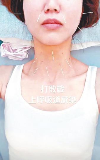互聯網圖片吳若希 互聯網圖片吳若希