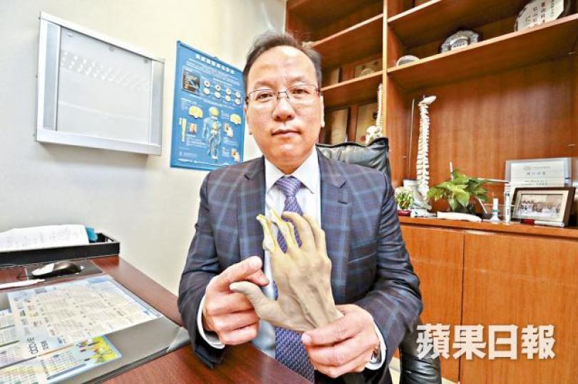 醫生郭文亮指,類風濕性關節炎患者及早治療,可預防關節變形。黃耀興攝 醫生郭文亮指,類風濕性關節炎患者及早治療,可預防關節變形。黃耀興攝