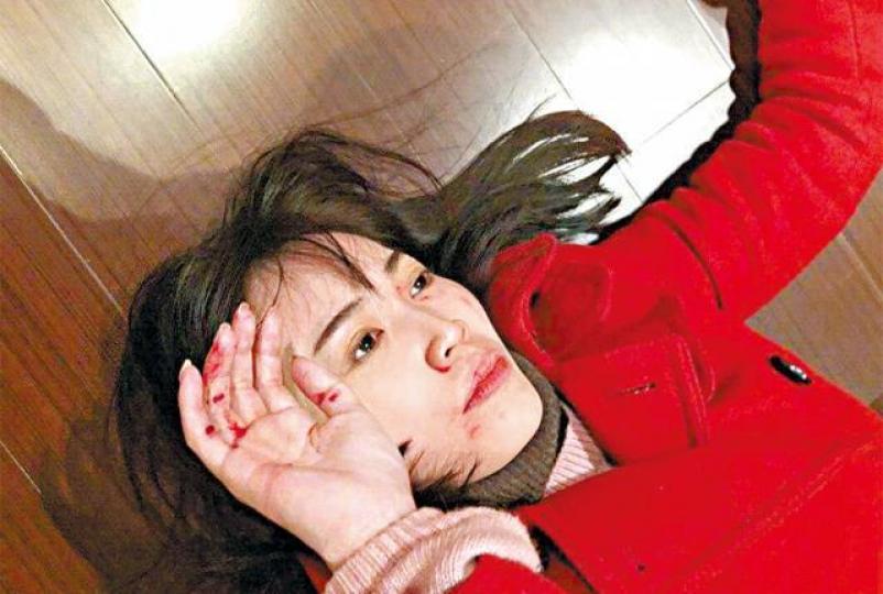 馬蓉聲稱王寶強帶同四、五人對她拳打腳踢,又指王寶強要殺她。微博圖片疑似馬蓉在王寶強家門前企圖打落閉路電視。微博圖片王寶強兩年前發現馬蓉有外遇,今年法庭終判決解除雙方婚姻關係。資料圖片 馬蓉聲稱王寶強帶同四、五人對她拳打腳踢,又指王寶強要殺她。微博圖片疑似馬蓉在王寶強家門前企圖打落閉路電視。微博圖片王寶強兩年前發現馬蓉有外遇,今年法庭終判決解除雙方婚姻關係。資料圖片