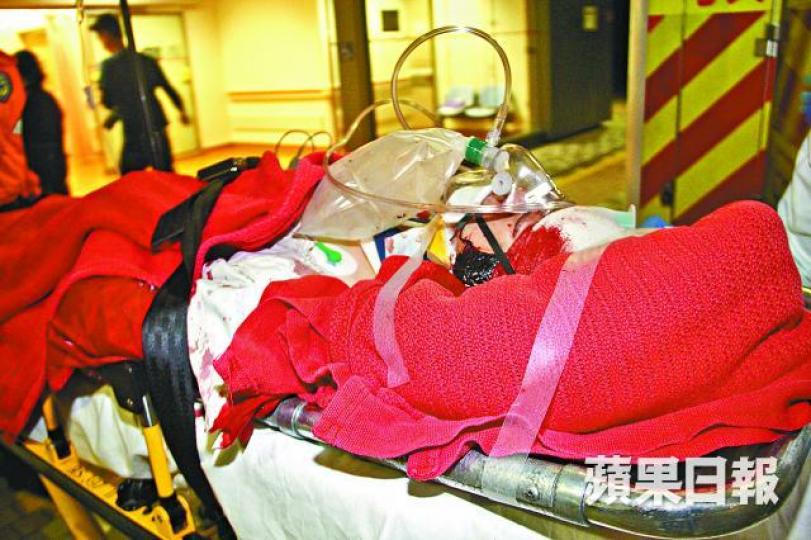 被斬女子送院時血流披面。黎志偉攝 被斬女子送院時血流披面。黎志偉攝