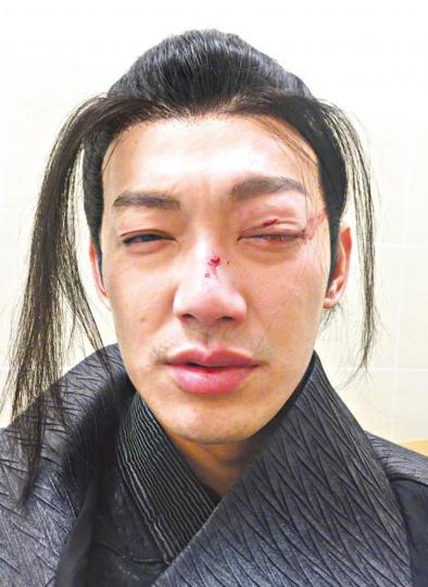威廉日前拍攝《異瞳神探》時發生意外，俾木劍打傷眼。微博圖片威廉指食得呢行飯，就想堅持做到好。微博圖片吳克群（左）聽見好兄弟威廉受傷後第一句話最怕冇得再拍，大受感動。互聯網圖片威廉（左二）曾是棒棒堂成員，後來轉戰內地拍劇。資料圖片