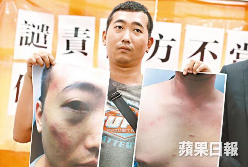 傘運路經旺角被警打傷的梁偉文,獲賠18.9萬元。 傘運路經旺角被警打傷的梁偉文,獲賠18.9萬元。