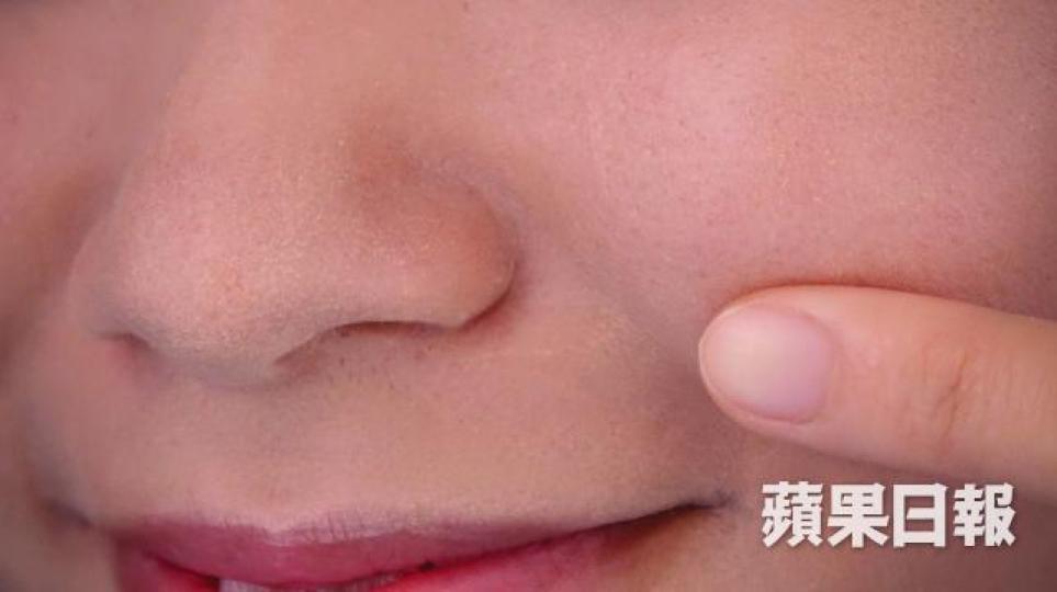 過敏性鼻炎的主要症狀有鼻癢、打噴嚏、流清涕、鼻塞。 過敏性鼻炎的主要症狀有鼻癢、打噴嚏、流清涕、鼻塞。