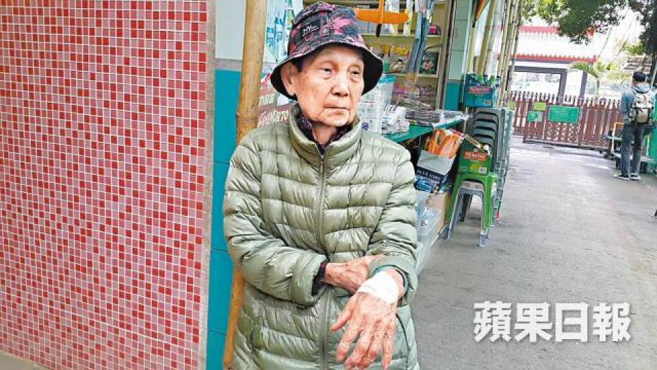 張婆婆展示左手背傷處時,泣訴無意與家人修補關係。 張婆婆展示左手背傷處時,泣訴無意與家人修補關係。