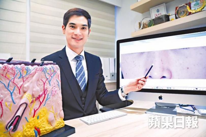 林旭強指使用防曬產品可防雀斑及皮膚癌。何頴賢攝 林旭強指使用防曬產品可防雀斑及皮膚癌。何頴賢攝