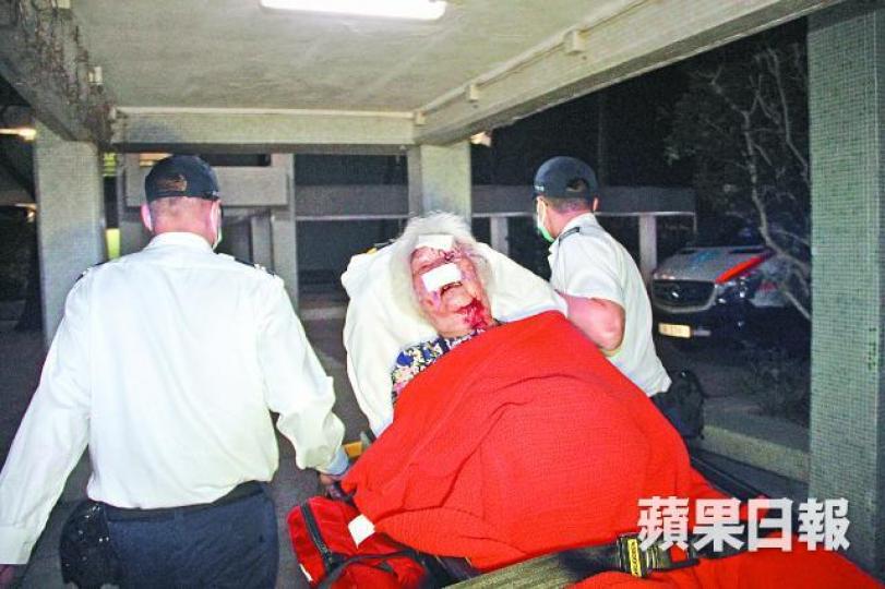受傷老婦由救護員送院治理。李家傑攝大廈外牆煤氣管有五米長刺網,探員爬梯調查。警員在案發單位(箭嘴示)樓下調查。 受傷老婦由救護員送院治理。李家傑攝大廈外牆煤氣管有五米長刺網,探員爬梯調查。警員在案發單位(箭嘴示)樓下調查。