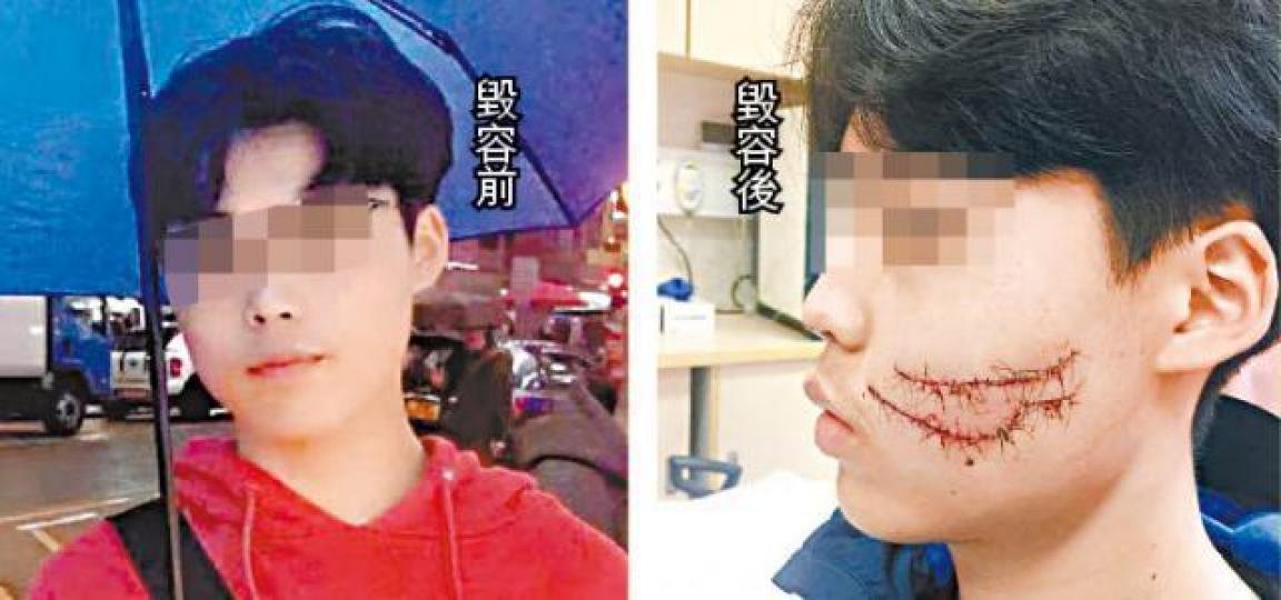 森仔母親誓言追究到底,要還兒子一個公道。張 軍攝 森仔母親誓言追究到底,要還兒子一個公道。張 軍攝