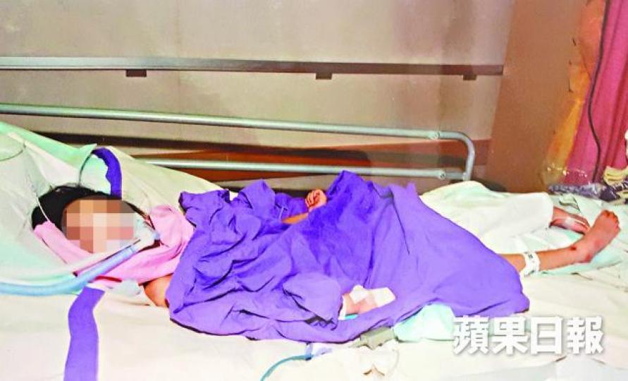 女童林林被生母嚴重虐待,腦部永久受損成植物人。資料圖片 女童林林被生母嚴重虐待,腦部永久受損成植物人。資料圖片