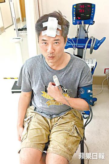 邵仲衡笑言收咗利是當係鴻運當頭，會休息兩日再開工。邵仲衡前日被攝影機扑爆額頭，但佢堅持收工後先去醫院。