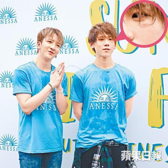 姜濤（右）被Anson Lo撞到眼肚腫起，Anson尷尬道歉。MIRROR完成表演後，姜濤即用濕毛巾敷眼，但Anson Lo唔知整親佢。