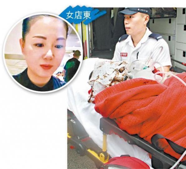 女東當日遇襲送院,敷着的面膜滲出血水;圓圖為她事發前容貌。被告但昭娟於高院被判囚12年。張志華攝 女東當日遇襲送院,敷着的面膜滲出血水;圓圖為她事發前容貌。被告但昭娟於高院被判囚12年。張志華攝